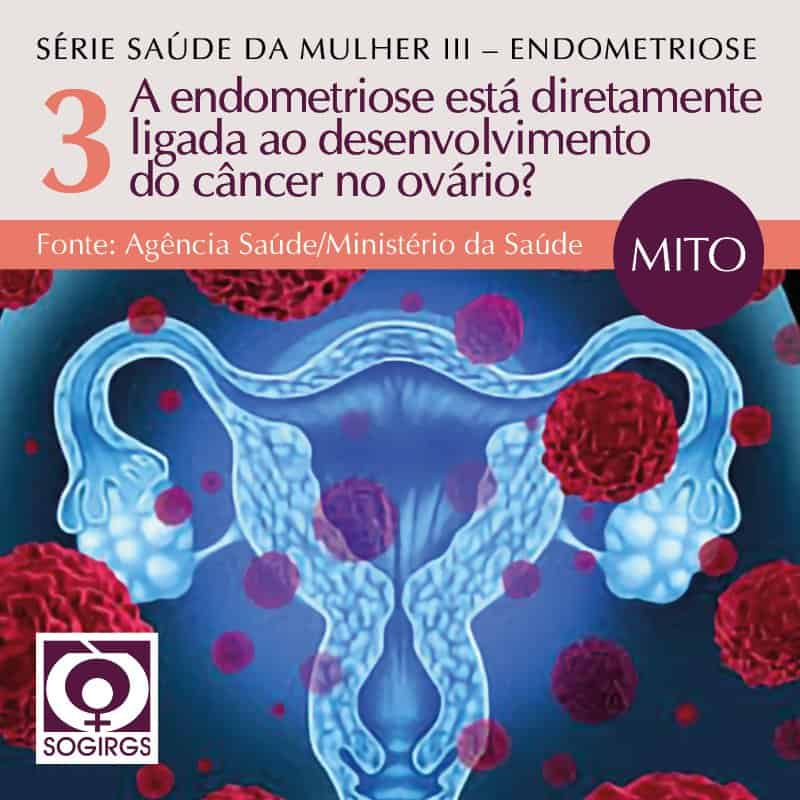 Endometriose Mitos E Verdades Sobre A Doen A Que Afeta Das