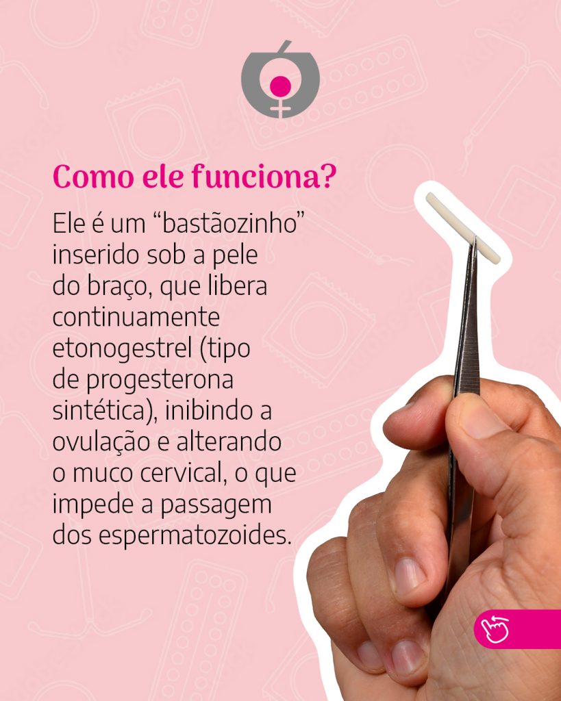 Card-16-07-2025-novo-metodo-contracepcao-3