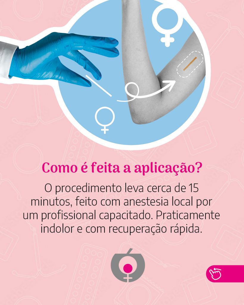 Card-16-07-2025-novo-metodo-contracepcao-4